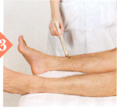 尿道炎艾灸