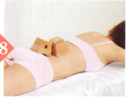 子宮脫垂艾灸