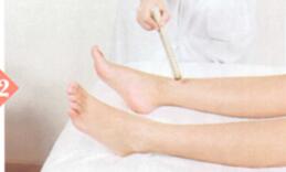 腳氣艾灸