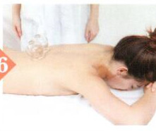 調經止帶拔罐