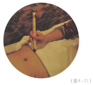 低血壓艾灸