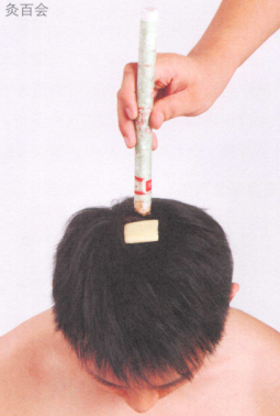 脫肛艾灸