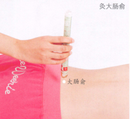 外陰瘙癢癥艾灸