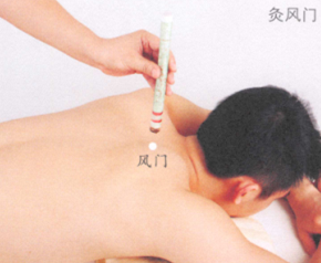 預防感冒艾灸