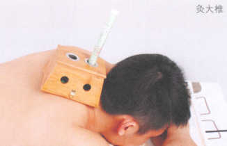 預防感冒艾灸