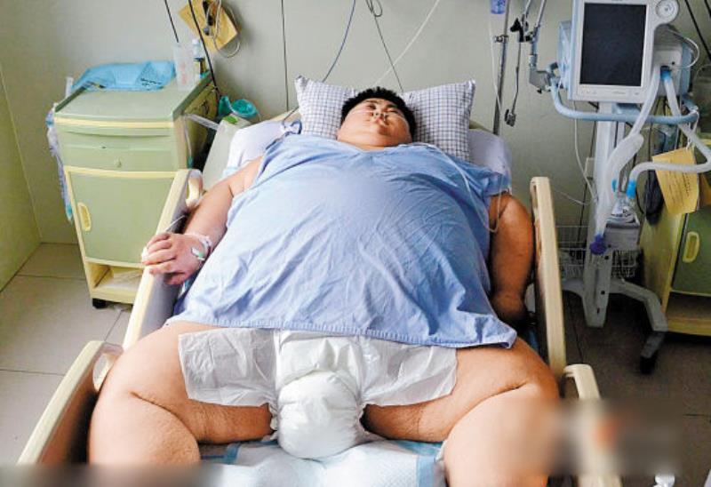 中國第一胖心肺衰竭去世(圖)