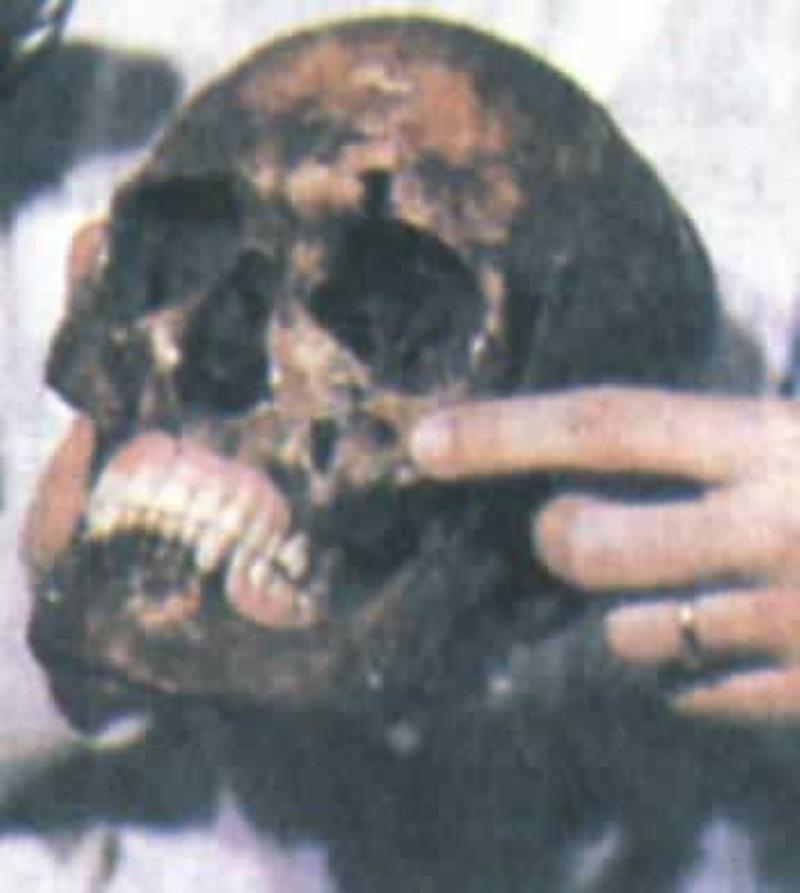 死亡天使門(mén)格爾被證明已死
