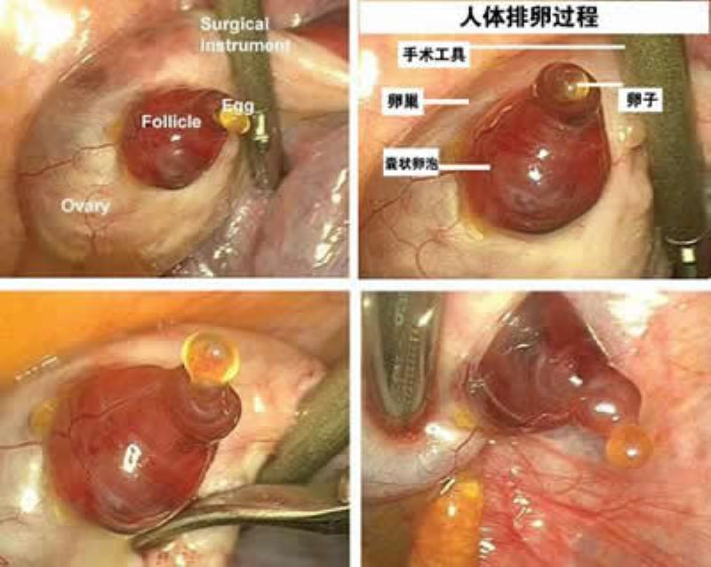 首次拍得人類排卵的過程
