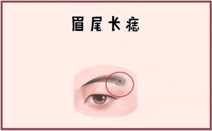 女人眉尾有痣代表什么含義 一、解析女人眉尾有痣代表的意思