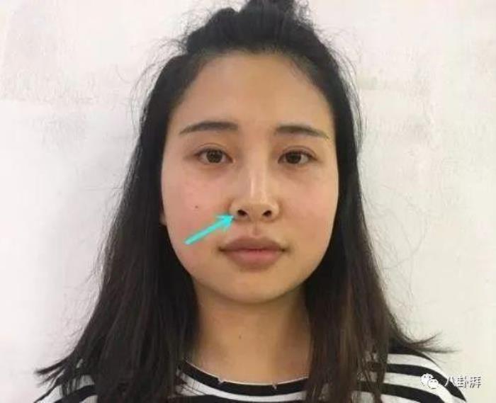 人有朝天鼻運(yùn)勢(shì)如何 朝天鼻的人都很丑