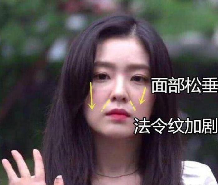 法令紋有痣代表什么 一、什么是法令紋