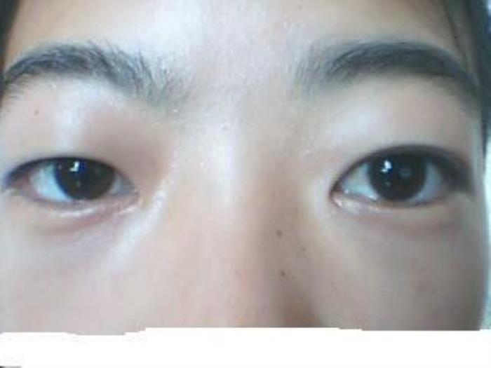 女人有點(diǎn)金魚眼面相是好的嗎？ 什么是金魚眼