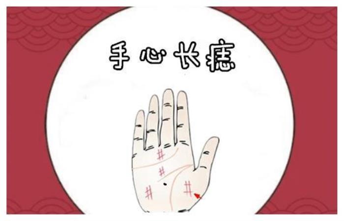 掌心有痣是什么的標志？ 男人右手掌心有痣代表什么