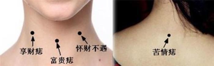 男人脖子有痣代表什么 女人脖子上的痣圖解