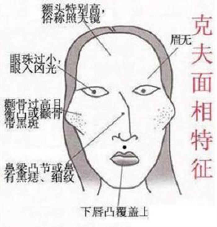 女人克夫的面相 夫妻相克表太準(zhǔn)了