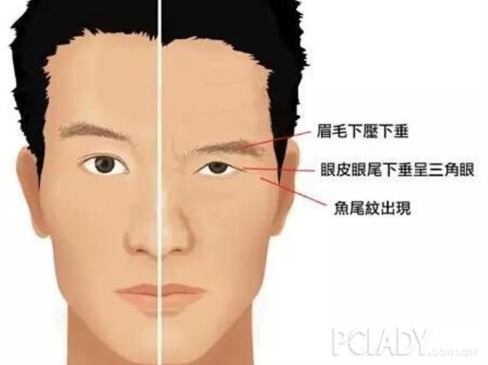 眼角下垂的男人面相好不好 男人上眼皮下垂面相