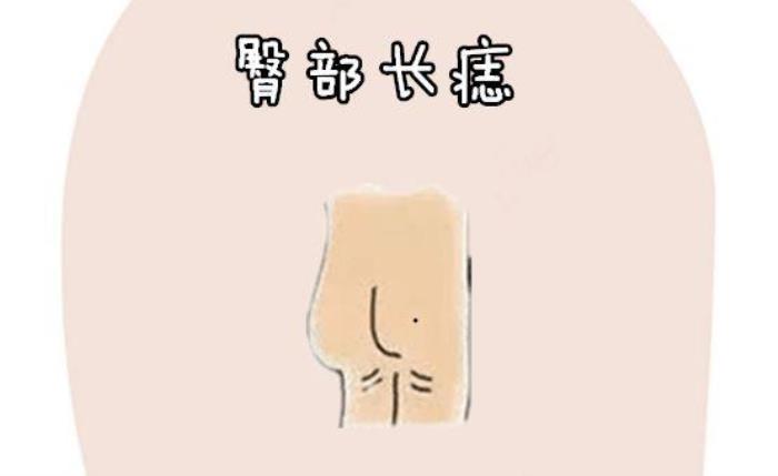 屁股上有痣代表什么 女人少見(jiàn)的極富貴痣