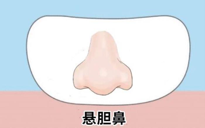 易漏財(cái)?shù)谋亲佑心男?漏財(cái)怎么化解