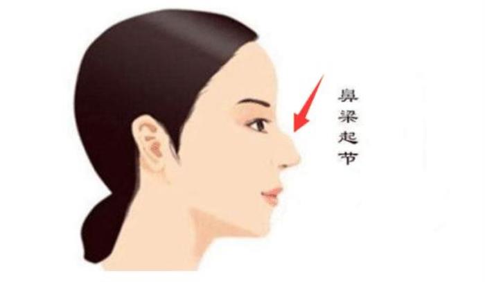 劍脊鼻容易破財嗎 容易破財?shù)娜巳绾问刎?><br><p>劍脊鼻的女性，事業(yè)心長短常不錯的，盡管這人的婚姻欠安，但事業(yè)有十分多的人協(xié)助，能夠實現(xiàn)他人實現(xiàn)不了的工作，本身對于任務有一種過火的固執(zhí)。擅長從事科研任務，有刻苦刻苦的精力。</p><p>劍脊鼻的人，此種面相的人是有很強的事業(yè)心的，看待事業(yè)仔細擔任，任務才能強，屬于任務狂，由于任務廢寢忘食，斬釘截鐵，從不虛言令色。對于財帛之物把握欲也比擬強，擅長理財。</p><p>劍脊鼻的人，對于戀愛較差，屬于終身孤獨之人，簡單孤獨畢生，事業(yè)忙繁忙碌。糊口很是不容易，與怙恃干系自幼欠好，兄弟姐妹也沒法協(xié)助本人，不善運營糊口，怙恃也沒法協(xié)助本人，大都乃孤單終老之人。暮年較為崎嶇。</p><p>劍脊鼻的人，身體尚可，朝上進步才能很強，壽元尚可。</p>

          <p>本文地址:http://www.mcys1996.com/jiajufs/471624.html.</p>
          <p style=