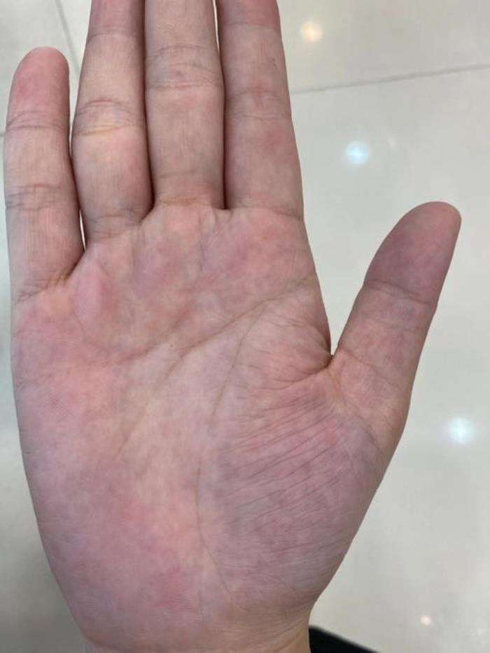 手紋亂的女人手相運勢 一、手紋整體亂，易心事不寧