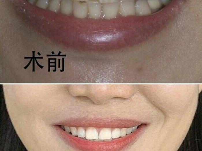 門牙有縫有什么說法 女人門牙有縫代表什么