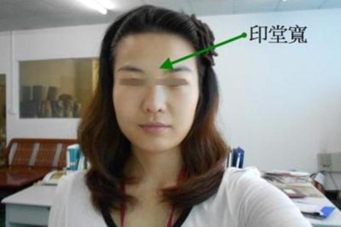 印堂凹陷的女人運好不好 印堂凹陷女人面相解析