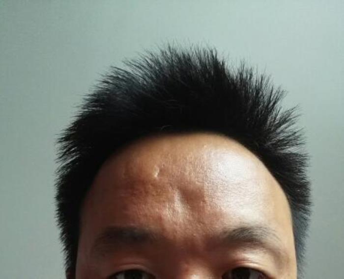 額頭窄會帶來霉運(yùn)嗎 是不是額頭窄的人就不好