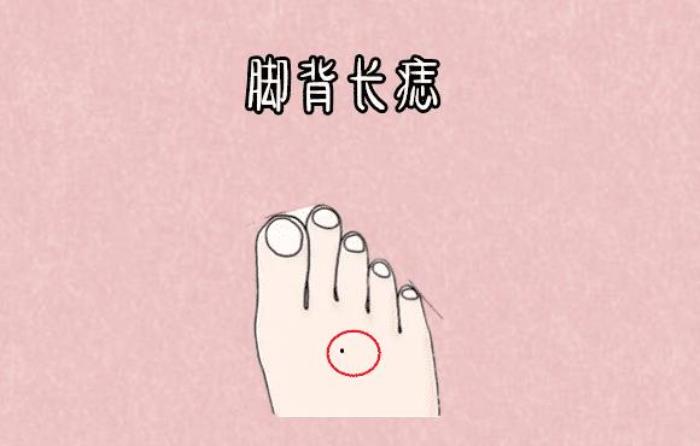 右腳背長(zhǎng)痣 腳背上長(zhǎng)痣是菩薩轉(zhuǎn)世