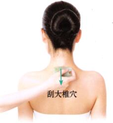 高血壓刮痧