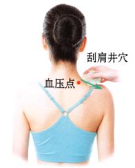 高血壓刮痧
