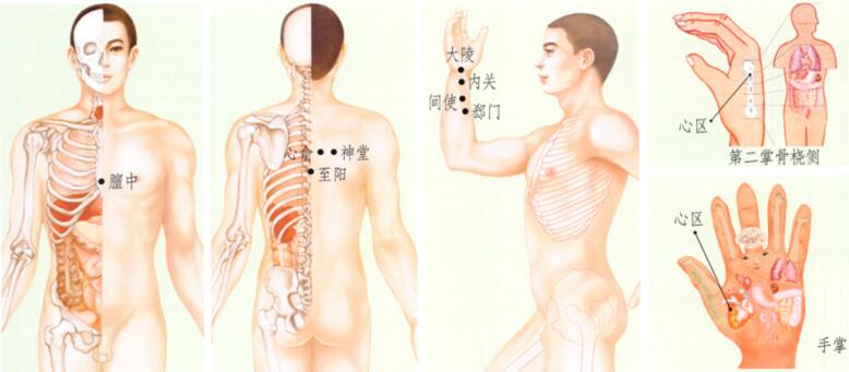心絞痛刮痧
