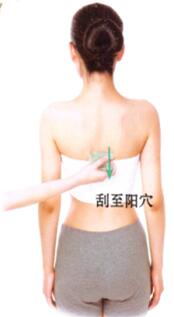 心絞痛刮痧