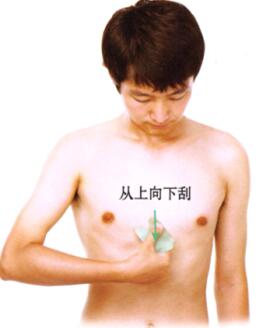 心絞痛刮痧