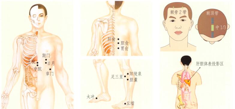 膽囊炎-膽石癥刮痧
