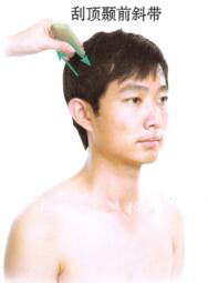 中風后遺癥刮痧