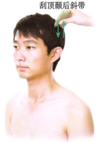 風(fēng)濕性關(guān)節(jié)炎刮痧
