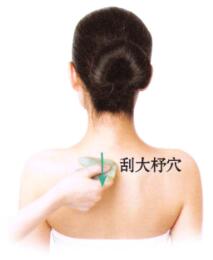 風(fēng)濕性關(guān)節(jié)炎刮痧