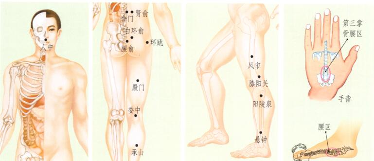 腰椎間盤突出刮痧