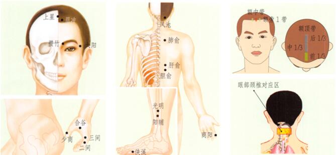 目赤腫痛刮痧