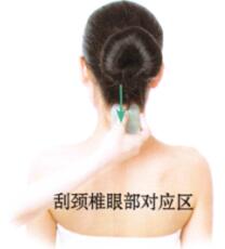 目赤腫痛刮痧