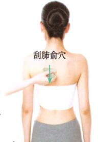 目赤腫痛刮痧