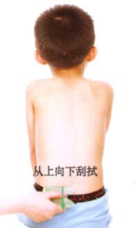小兒便秘刮痧