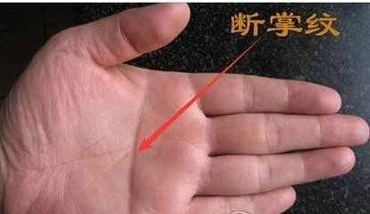 斷掌紋好不好_斷掌紋上有像環(huán)形的東西好不好<div   id=