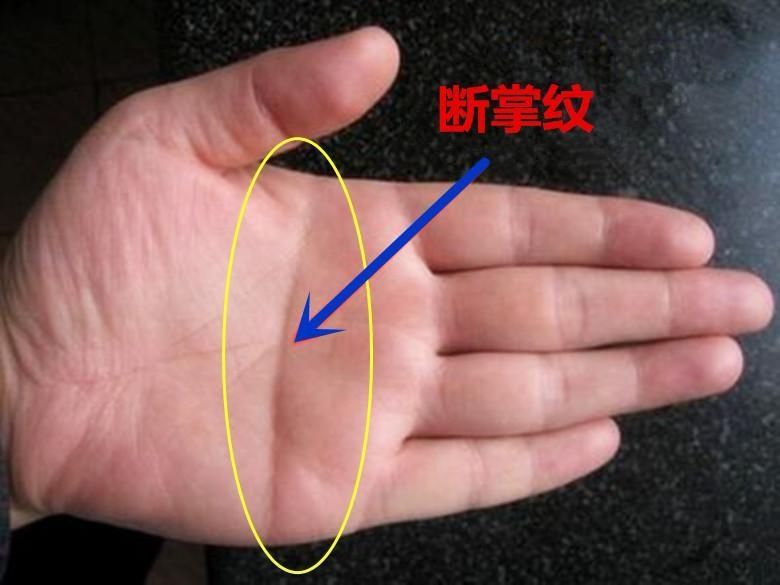 斷掌紋好不好_斷掌紋_斷掌紋上有像環(huán)形的東西好不好<div   id=