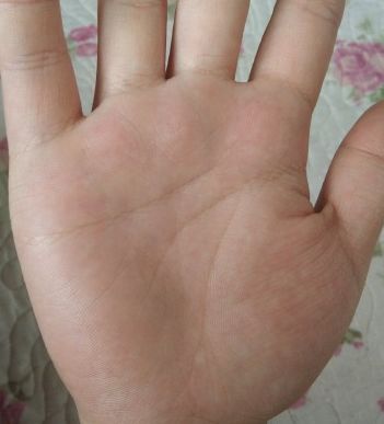斷掌紋_斷掌紋上有像環(huán)形的東西好不好<div   id=