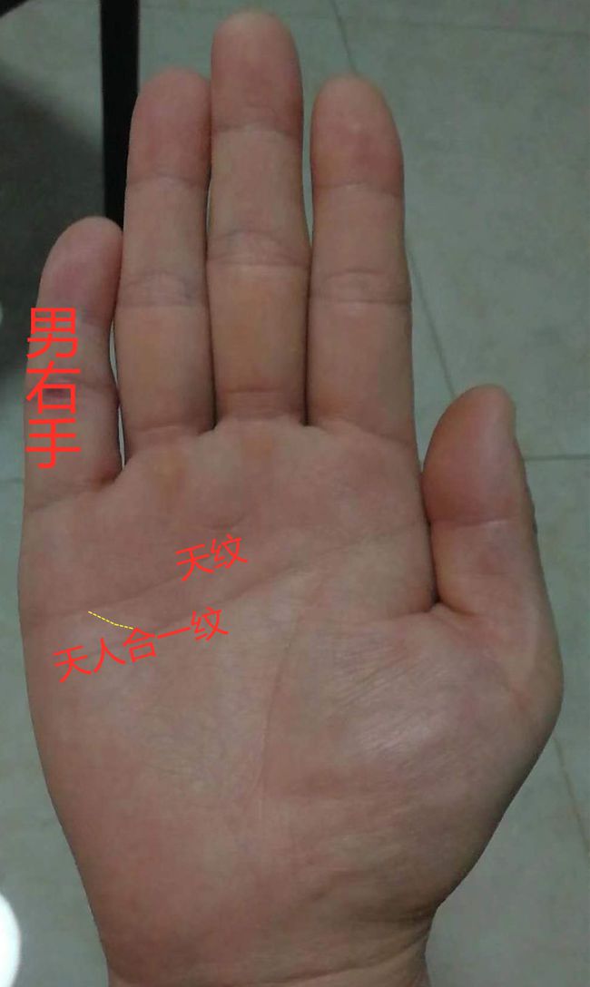 女人左手斷掌紋_斷掌紋的女人_男人左手斷掌紋