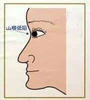 男人山根低是什么樣的_山根低_山根低鼻梁高面相
